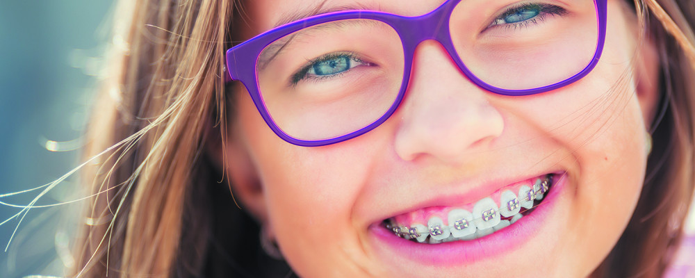 Orthodontie et petites lésions